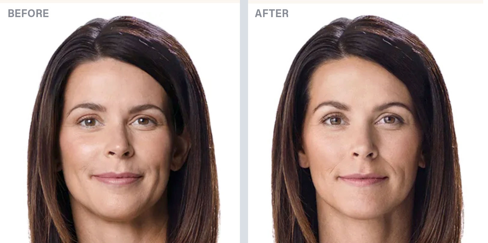 before-after-derma-1