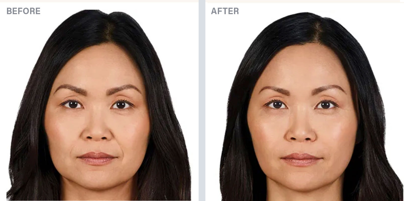 before-after-derma-2